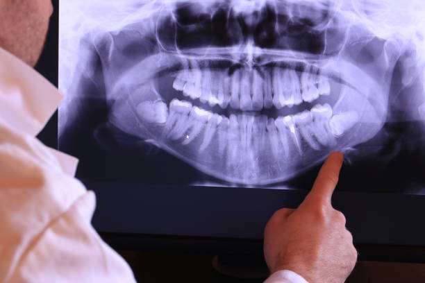 Best Emergency Dental Extractions in Early, TX